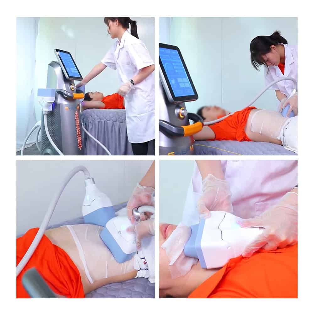emsculpt before and after inner ball roller machine for body sculpting S26 2 在 1 冷冻溶脂 Endos Velapro 内球滚轮按摩器减肥机