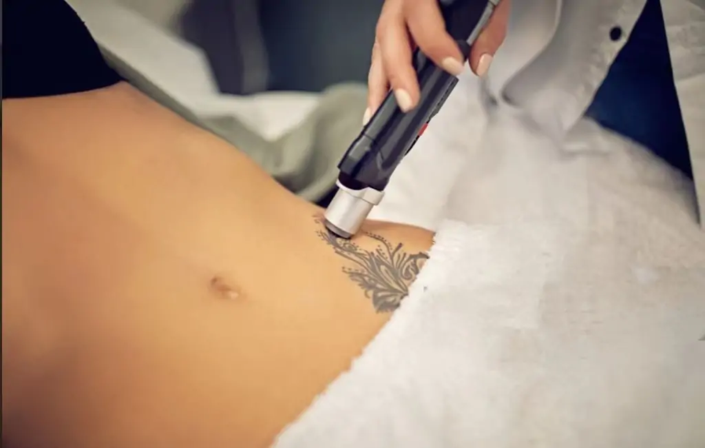 what is the lastest tattoo removal technology