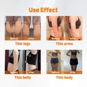 lipo laser rf radio frequency ems muscle stimulator lipo laser before and after 1 treatment does laser lipo work before and after best laser lipo machine 2024